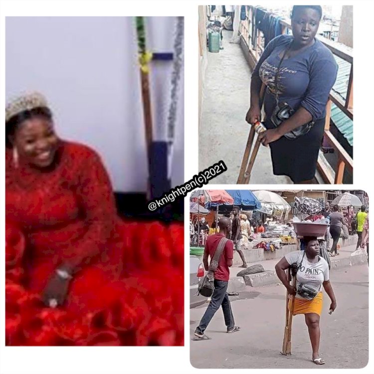 DESPERATE INFLUENCERS IMPACTS ON THE OSHODI AMPUTEE FAKE STORY